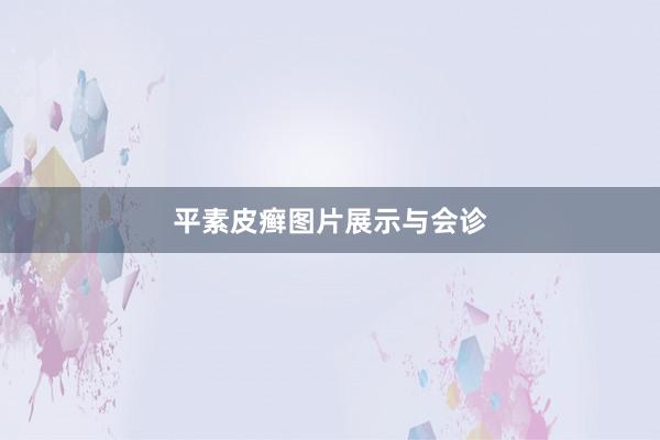 平素皮癣图片展示与会诊